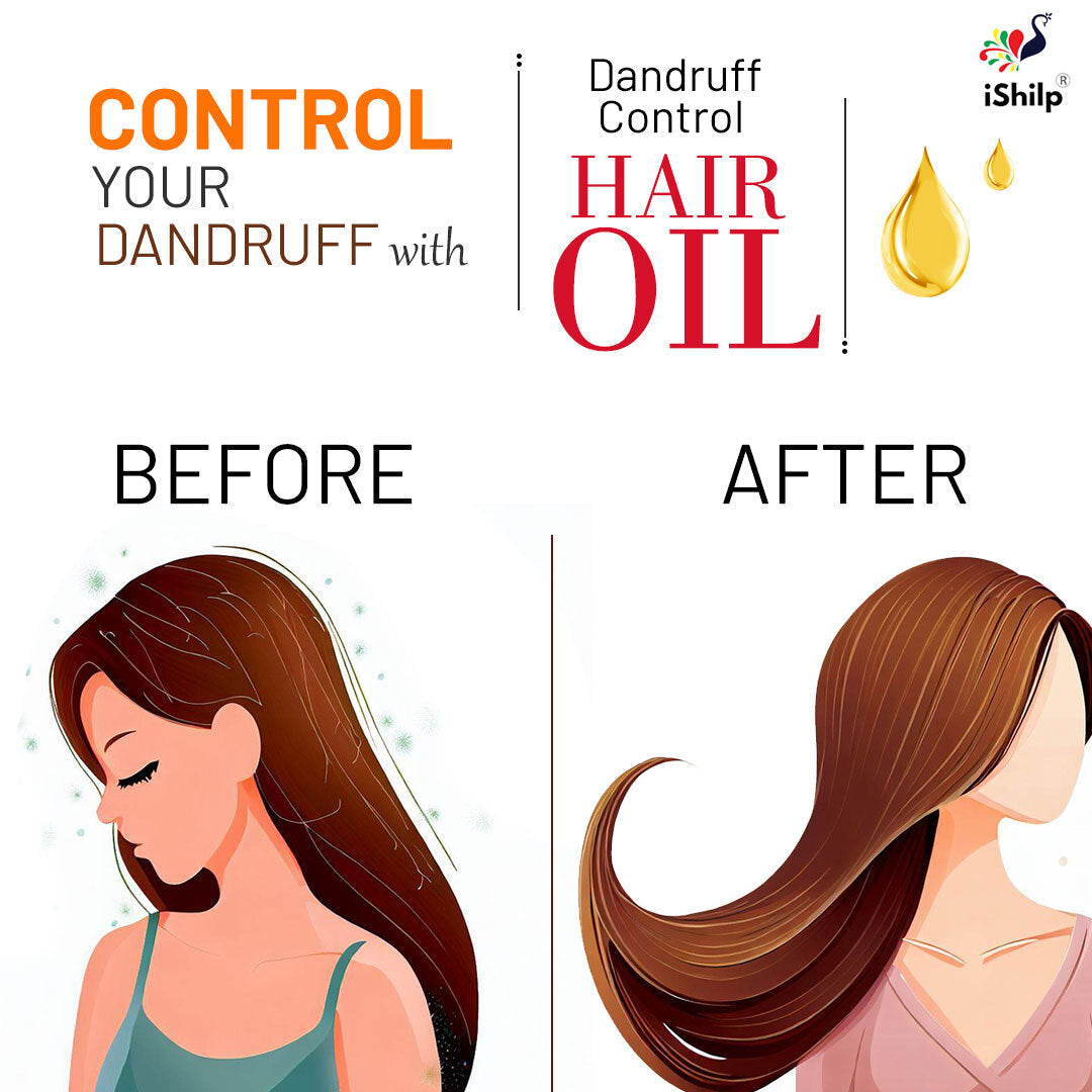 Dandruff Control Hair Oil